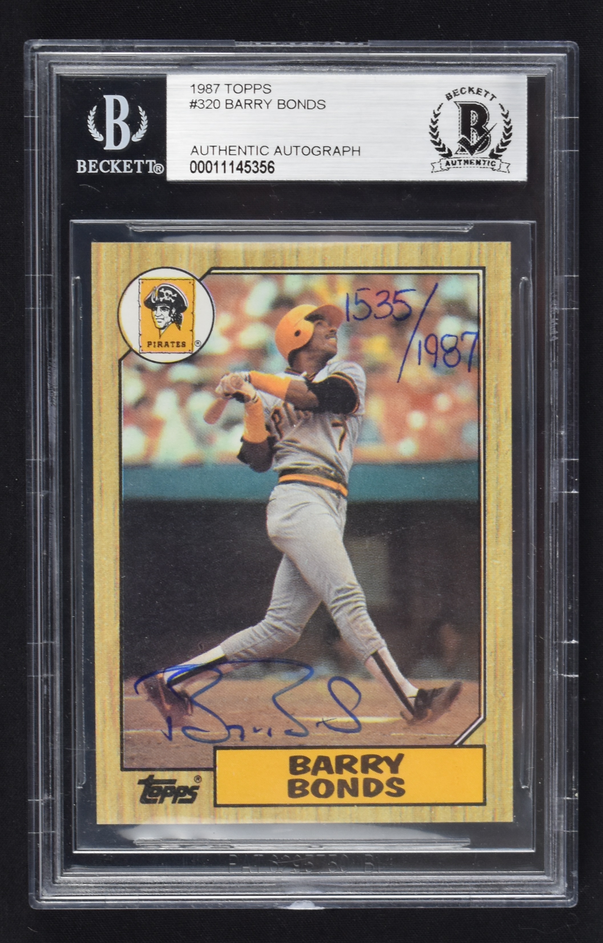 Hidden Value: Unlocking The Secrets Of 1987 Topps